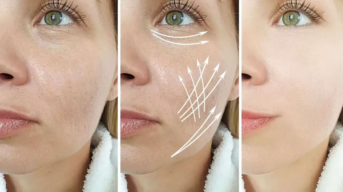 Can One Treatment Really Tackle More Than One Skin Concern Bracknell?