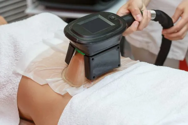 Image of person having fat freezing treatment to help weight gain Bracknell