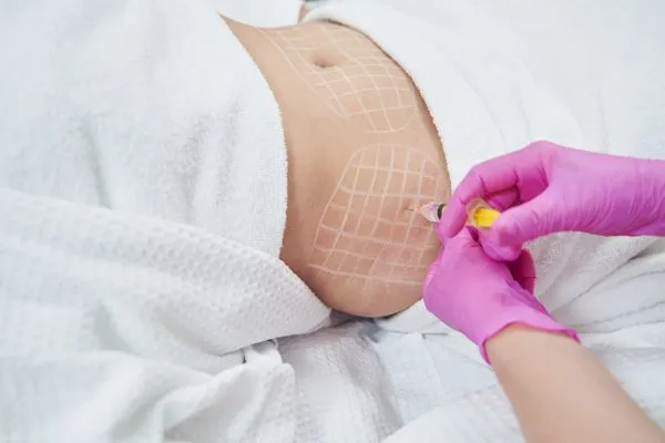 image of fat dissolving injections on love handles to help combat weight gain Bracknell