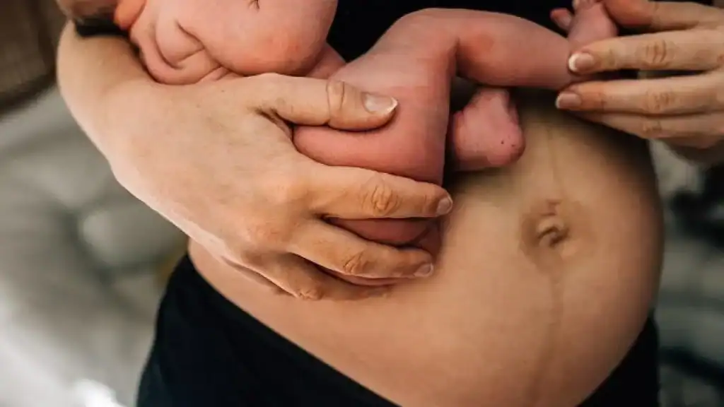 Why Is My Stomach Still Big After Pregnancy Bracknell?